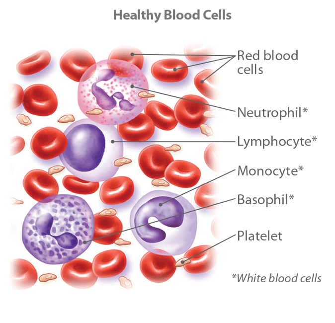 Blood Cancer Pictures Images