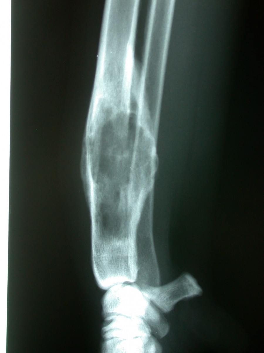 Bone Cancer In Dogs Leg X Ray