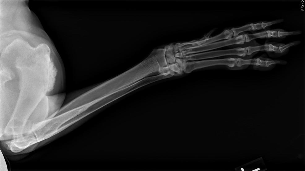 Bone Cancer X Ray Dog