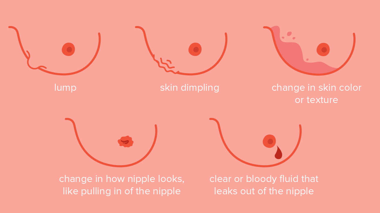 Breast Cancer Bumps On Skin