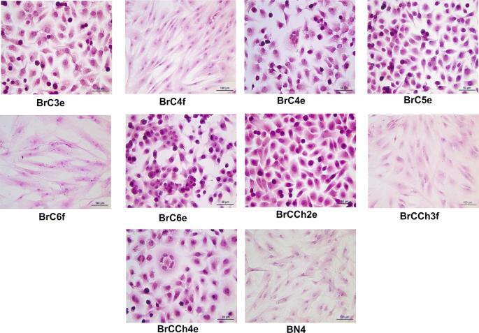 Breast Cancer Cells Vs Normal Cells