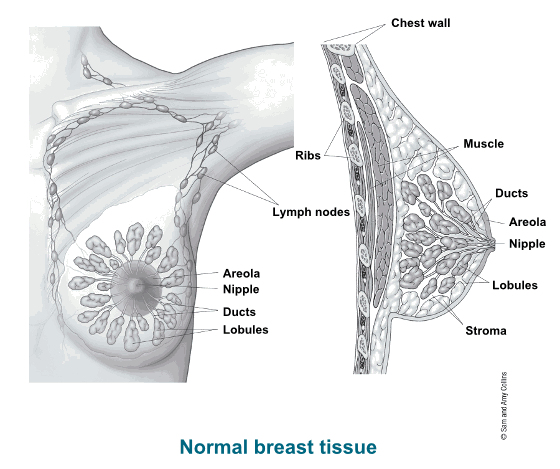 Breast Cancer Definition