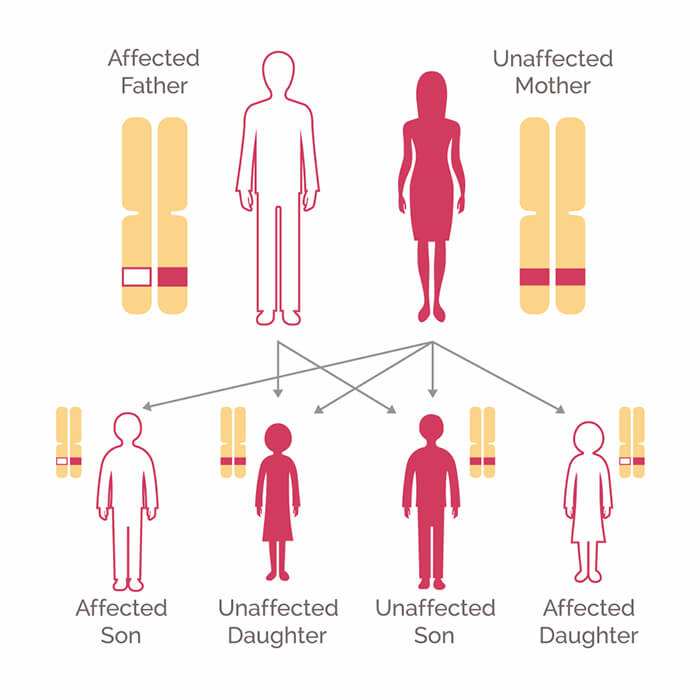 Breast Cancer Genetics Testing