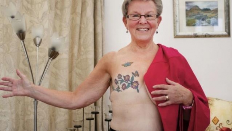 Breast Cancer Patient After Surgery