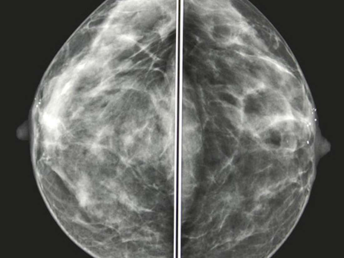 41+ Breast Cancer Reconstruction Photos
 Background